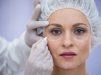 blepharoplasty west delhi